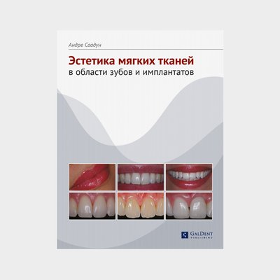 Эстетика мягких тканей в области зубов и имплантатов 7 фото