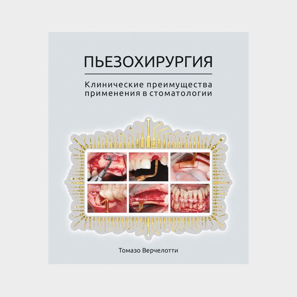 Пьезохирургия. Клинические преимущества применения в стоматологии 9 фото