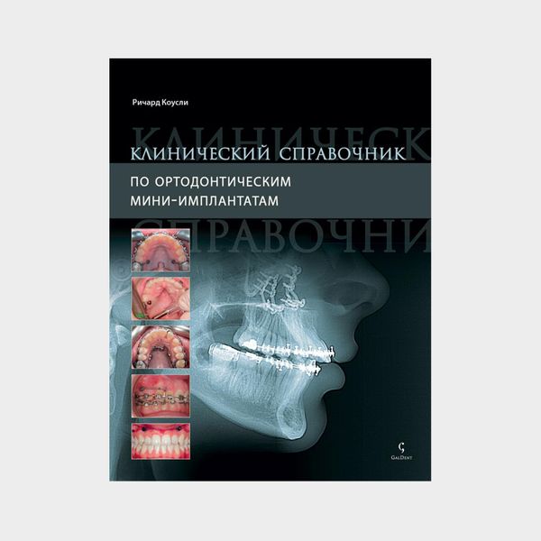 Клинический справочник по ортодонтическим мини-имплантатам 00184 фото